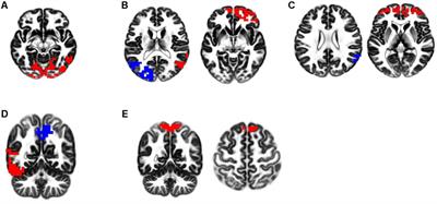 Bilateral Transcranial Magnetic Stimulation on DLPFC Changes Resting State Networks and Cognitive Function in Patients With Bipolar Depression